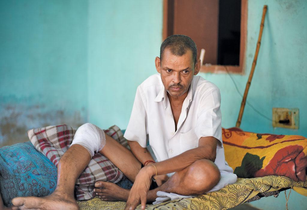 गुरुग्राम के बंधवाड़ी गांव निवासी घनश्याम दो साल से बीमार हैं। इनके परिवार का कहना है कि दूषित पानी बीमारी का कारण है (आदित्यन पीसी / सीएसई ) गुरुग्राम के बंधवाड़ी गांव निवासी घनश्याम दो साल से बीमार हैं। इनके परिवार का कहना है कि दूषित पानी बीमारी का कारण है (आदित्यन पीसी / सीएसई )