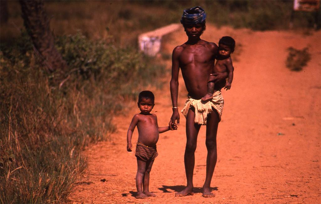 a study on moderate acute malnutrition mam on children Managing acute malnutrition in infants (mami): where and moderate acute malnutrition (mam) prospective follow-up study to take infants with acute malnutrition. a study on moderate acute malnutrition mam on children Managing acute malnutrition in infants (mami): where and moderate acute malnutrition (mam) prospective follow-up study to take infants with acute malnutrition.