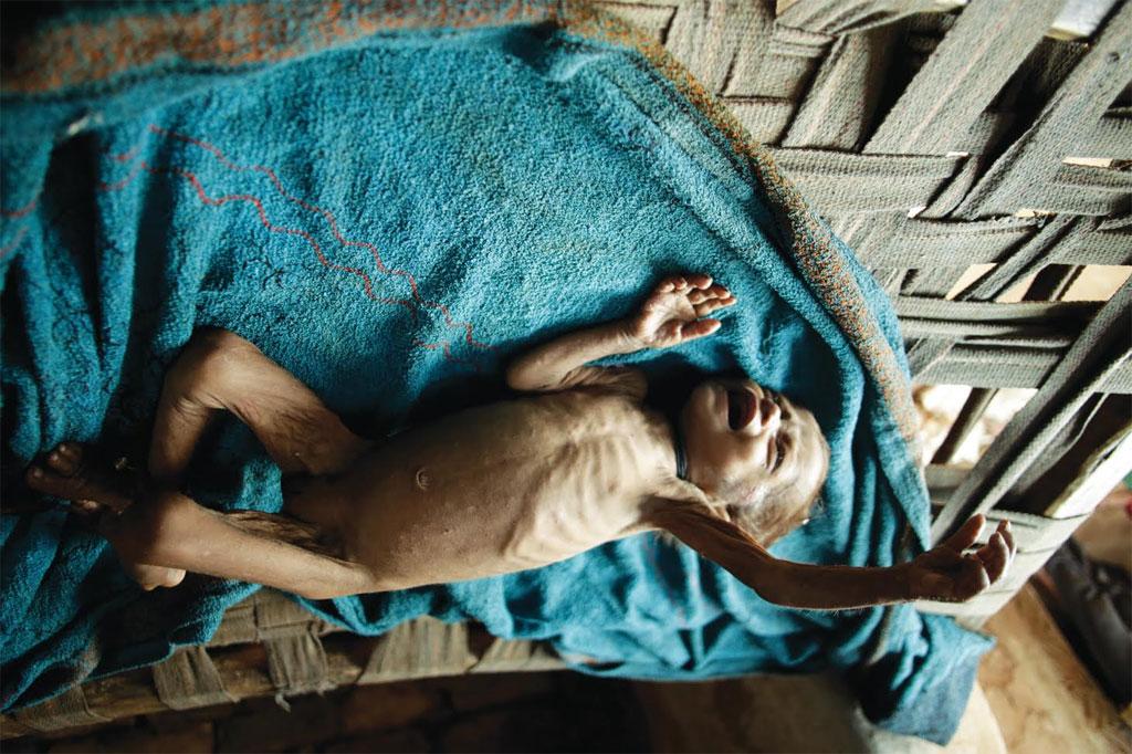 नाम:बेबी,
उम्र: ११ महीने,
वजन:3.4 किलो नाम:बेबी,
उम्र: ११ महीने,
वजन:3.4 किलो
