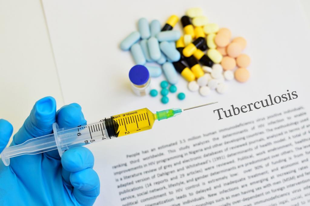 Faster Diagnostic Tests Developed For Tuberculosis