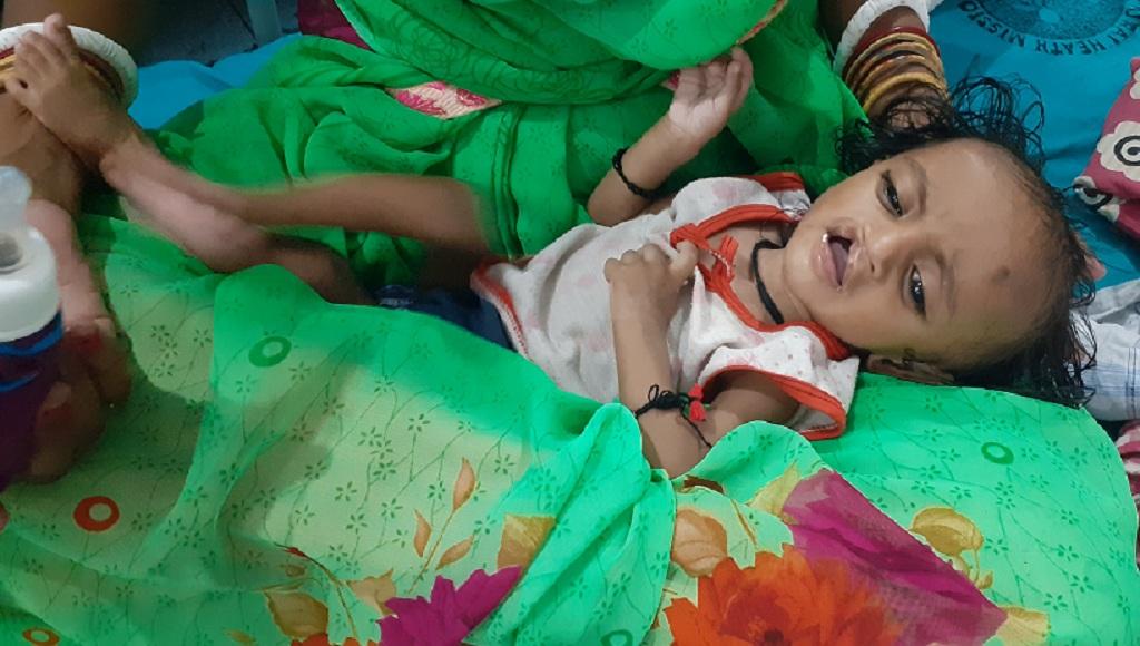 मुजफ्फरपुर के सदर अस्पताल परिसर में बने बीस बेड वाले पोषण पुनर्वास केंद्र में भर्ती बच्चा। फोटो: पुष्य मित्र मुजफ्फरपुर के सदर अस्पताल परिसर में बने बीस बेड वाले पोषण पुनर्वास केंद्र में भर्ती बच्चा। फोटो: पुष्य मित्र