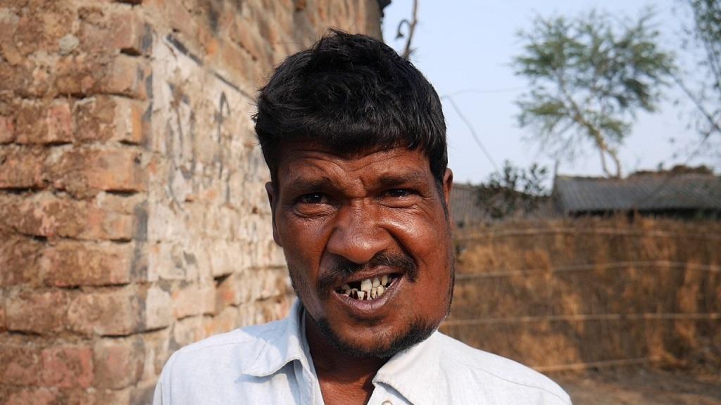 बिहार के सहरसा जिले के सत्तरकटैया प्रखंड का गांव सहरबा, जहां लोग कैंसर के शिकार हैं। फोटो: पुष्यमित्र बिहार के सहरसा जिले के सत्तरकटैया प्रखंड का गांव सहरबा, जहां लोग कैंसर के शिकार हैं। फोटो: पुष्यमित्र