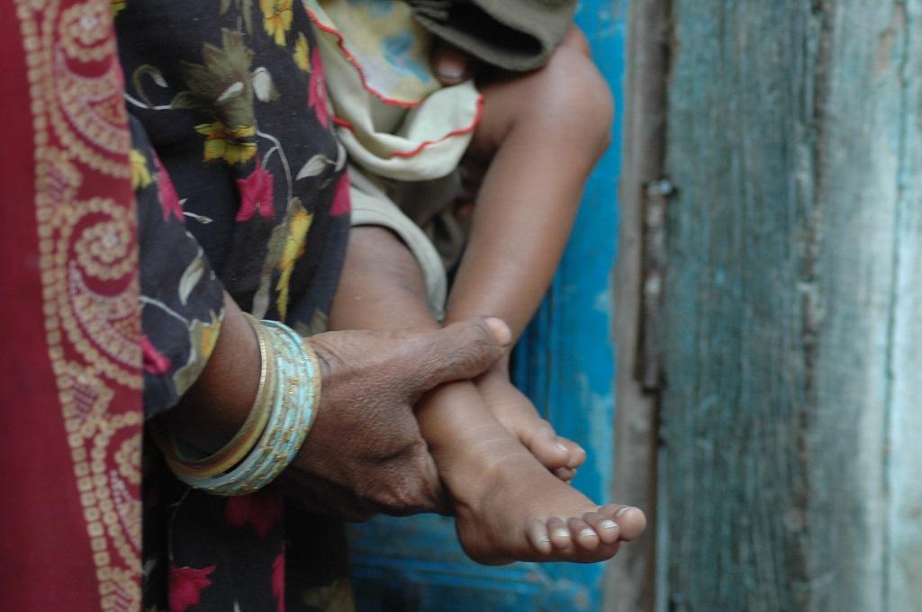 Polio Vaccination Polio Vaccination