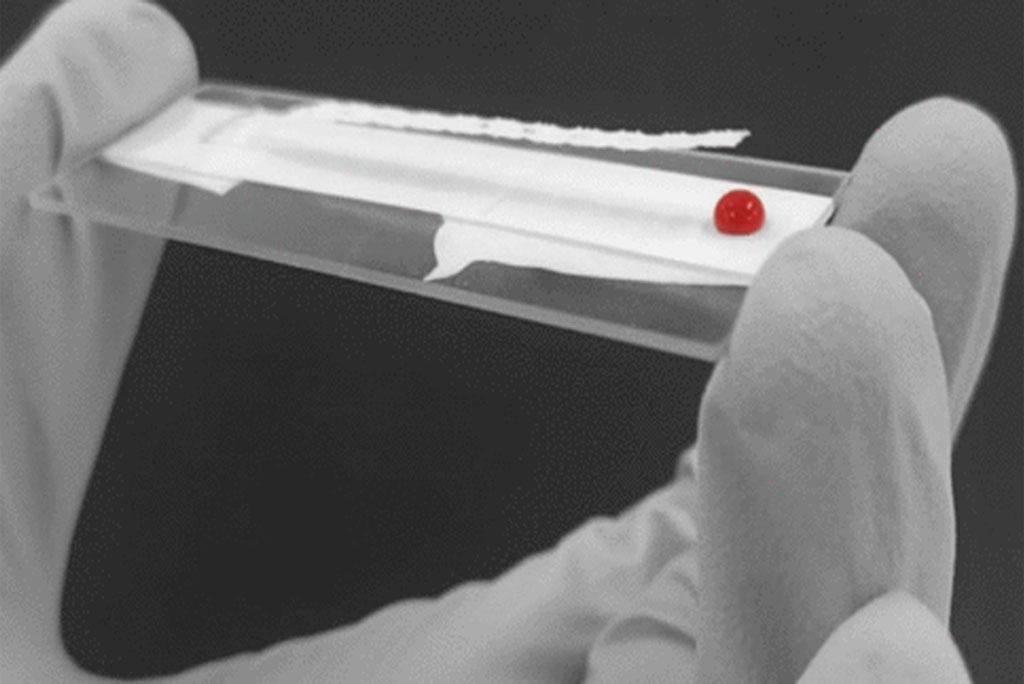 Fibrinogen test in blood Fibrinogen test in blood