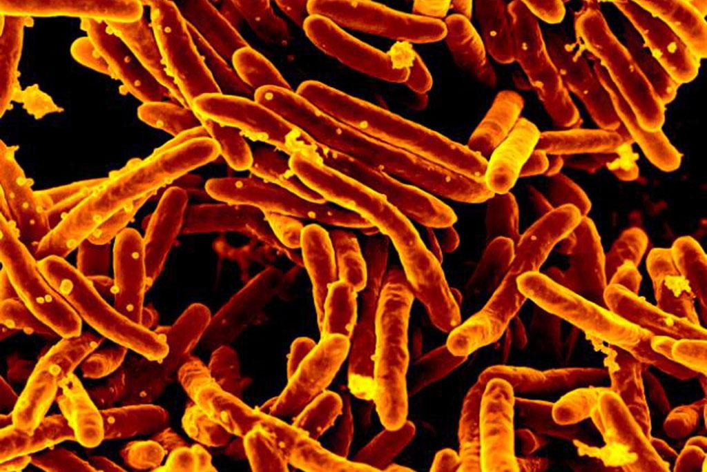 How TB bacteria are killing the effect of antibiotics faster How TB bacteria are killing the effect of antibiotics faster