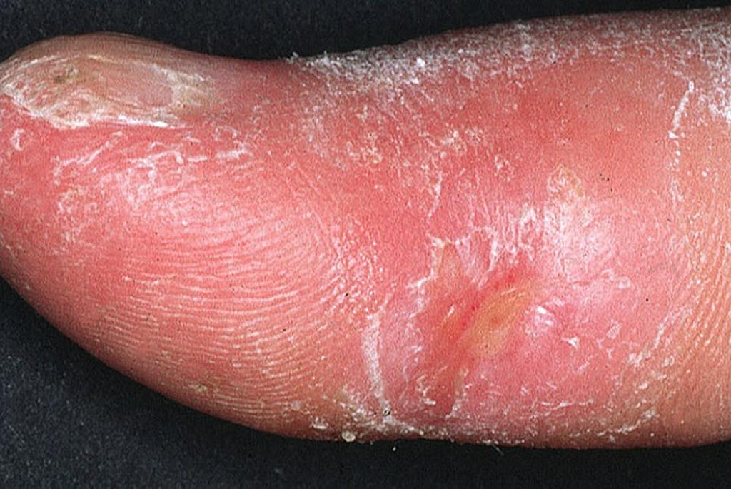 This technique can differentiate between fast, healthy and diseased skin, organs This technique can differentiate between fast, healthy and diseased skin, organs