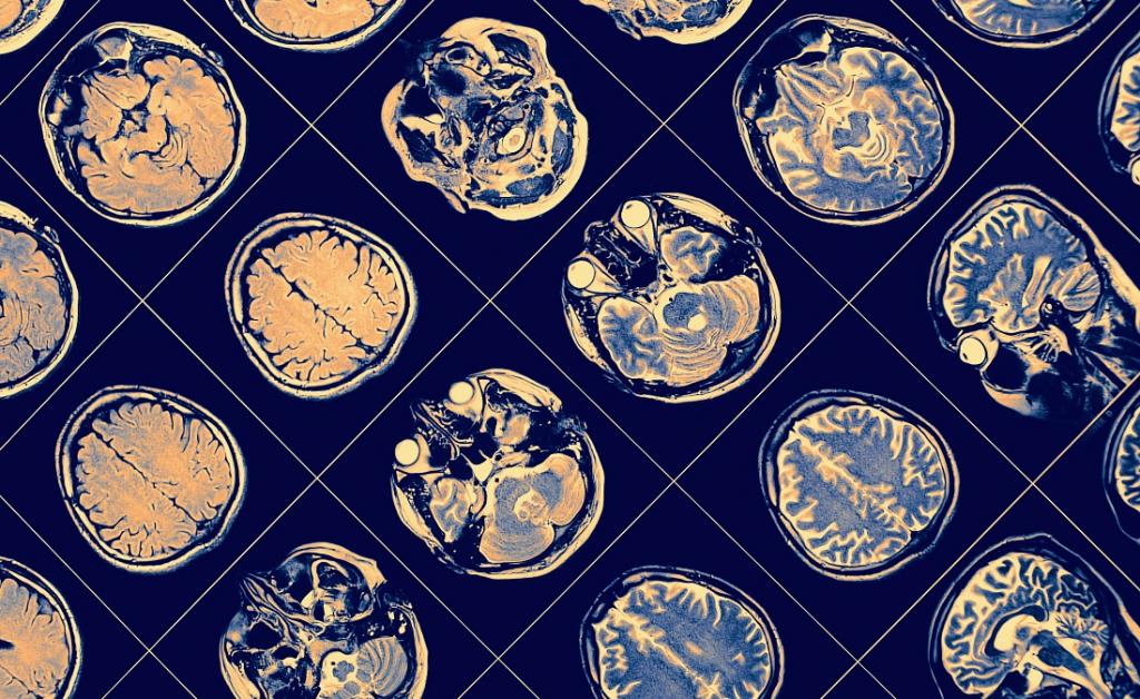 Socially isolated people have differently wired brains and poorer cognition – new research - Vimarsana News