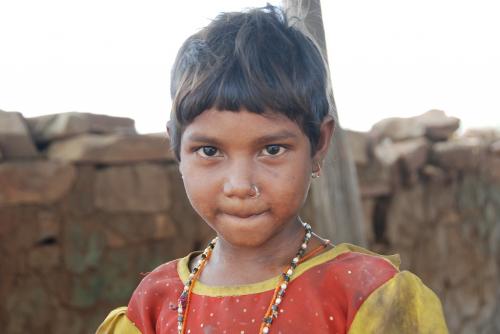 Madhya Pradesh govt in denial mode after 7-month-old dies due to malnutrition Madhya Pradesh govt in denial mode after 7-month-old dies due to malnutrition