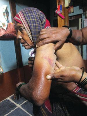 90-year-old Shidhava Sarwari was
beaten by the police in Yamanur.
A police crackdown took place
across Dharwad on July 28 and 29,
when protests against severe water
shortage turned violent (Photo: Nidhi Jamwal) 90-year-old Shidhava Sarwari was
beaten by the police in Yamanur.
A police crackdown took place
across Dharwad on July 28 and 29,
when protests against severe water
shortage turned violent (Photo: Nidhi Jamwal)